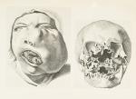 Goldschmid – Entwicklung und Bibliographie der Pathologisch-Anatomischen Abbildung.