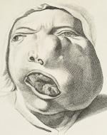 Goldschmid – Entwicklung und Bibliographie der Pathologisch-Anatomischen Abbildung.