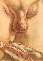 Goldschmid – Entwicklung und Bibliographie der Pathologisch-Anatomischen Abbildung.