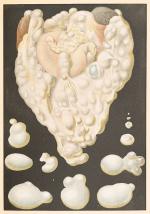 Goldschmid – Entwicklung und Bibliographie der Pathologisch-Anatomischen Abbildung.