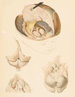 Goldschmid – Entwicklung und Bibliographie der Pathologisch-Anatomischen Abbildung.
