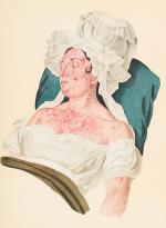 Goldschmid – Entwicklung und Bibliographie der Pathologisch-Anatomischen Abbildung.