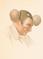 Goldschmid – Entwicklung und Bibliographie der Pathologisch-Anatomischen Abbildung.