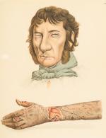 Goldschmid – Entwicklung und Bibliographie der Pathologisch-Anatomischen Abbildung.