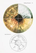 Jensen, The Science and Practice of Iridology.